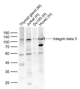 ITGB3 Rabbit Polyclonal Antibody