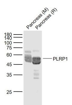 PLRP1 Rabbit Polyclonal Antibody