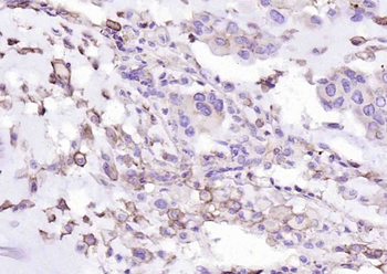PD-L1 Recombinant Rabbit Monoclonal Antibody