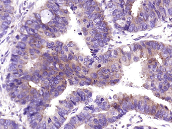 CALB2 Recombinant Rabbit Monoclonal Antibody