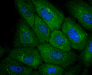 CXCR3 Recombinant Rabbit Monoclonal Antibody