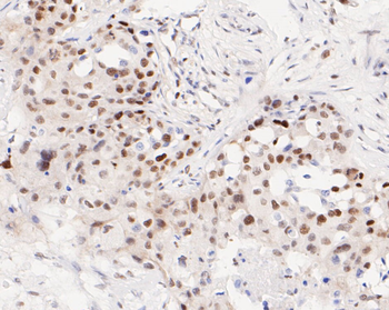 ATF4 Recombinant Rabbit Monoclonal Antibody
