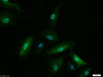 Mad2L1 Recombinant Rabbit Monoclonal Antibody