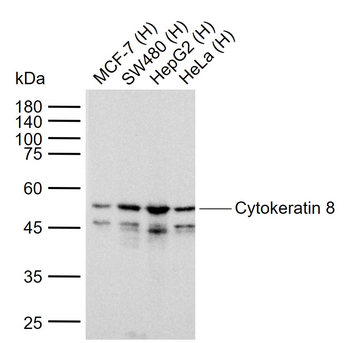 Cytokeratin 8 Recombinant Rabbit Monoclonal Antibody