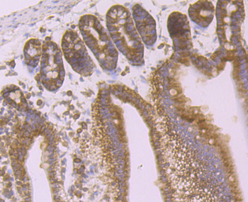 Desmoglein 2 Recombinant Rabbit Monoclonal Antibody