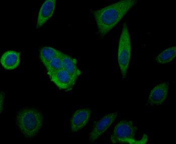 MARK3 Recombinant Rabbit Monoclonal Antibody