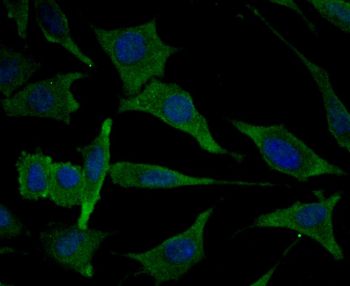 MARK3 Recombinant Rabbit Monoclonal Antibody
