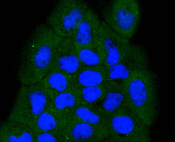 NADPH oxidase 4 Recombinant Rabbit Monoclonal Antibody