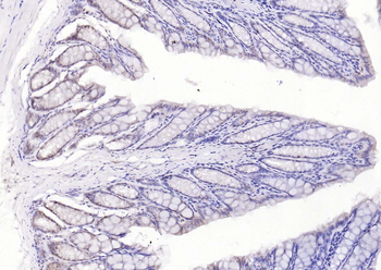 TSG101 Recombinant Rabbit Monoclonal Antibody