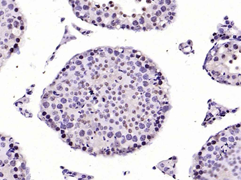 CAMK4 Recombinant Rabbit Monoclonal Antibody
