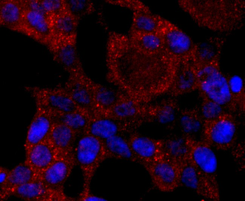 CYP2E1 Recombinant Rabbit Monoclonal Antibody