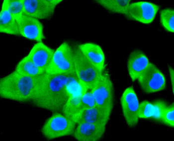 Tissue factor Recombinant Rabbit Monoclonal Antibody