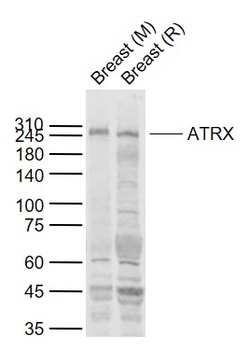 ATRX antibody