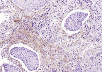 Collagen I Recombinant Rabbit Monoclonal Antibody