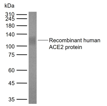 ACE2 Mouse Monoclonal Antibody