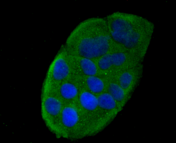 RANTES Recombinant Rabbit Monoclonal Antibody