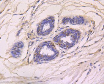 RANTES Recombinant Rabbit Monoclonal Antibody