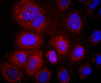 LYVE1 Recombinant Rabbit Monoclonal Antibody