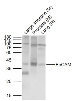 EpCAM antibody