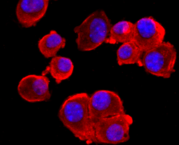 NMDAR1 Recombinant Rabbit Monoclonal Antibody