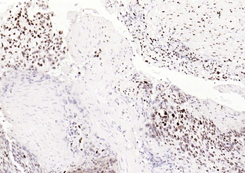 Bub3 Recombinant Rabbit Monoclonal Antibody