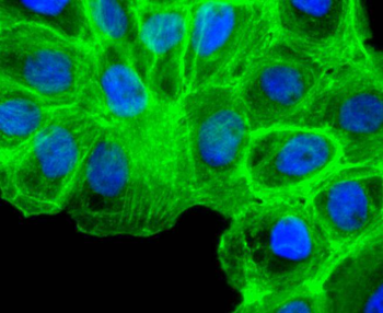 Alpha smooth muscle Actin Recombinant Rabbit Monoclonal Antibody