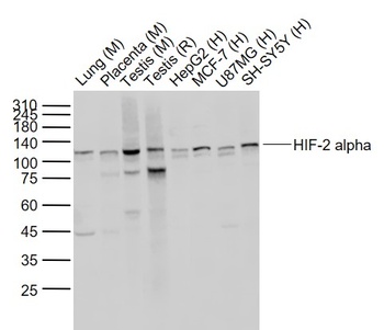 HIF-2 Alpha antibody