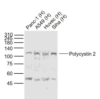 Polycystin 2 antibody