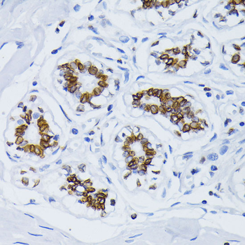 Lamin B1 Rabbit Polyclonal Antibody