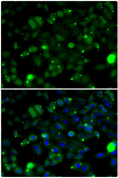 TAGLN2 Rabbit Polyclonal Antibody