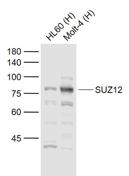 SUZ12 Rabbit Polyclonal Antibody