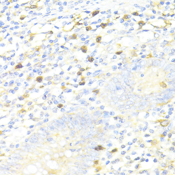 SQSTM1/p62 Rabbit Polyclonal Antibody