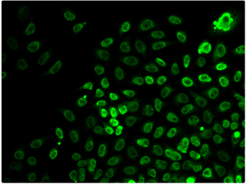SMARCA4 Rabbit Polyclonal Antibody