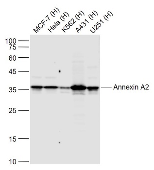 Annexin A2 (2F4) antibody