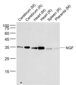 NGF antibody