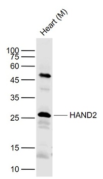 HAND2 antibody