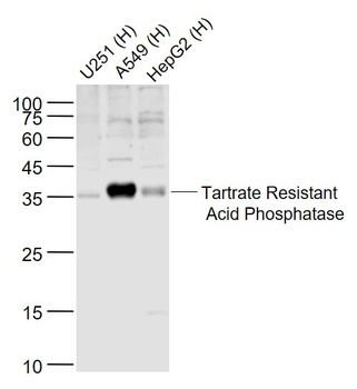 Tartrate Resistant Acid Phosphatase antibody