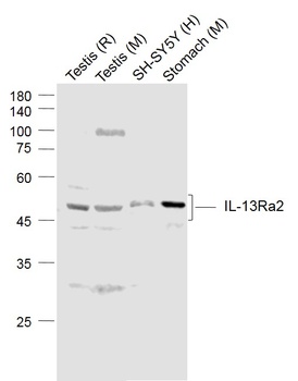 IL-13Ra2 antibody