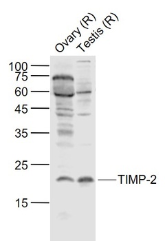 TIMP-2 antibody