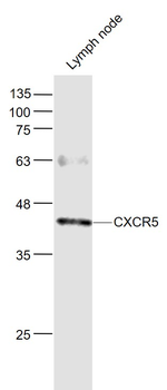 CXCR5 Rabbit Polyclonal Antibody