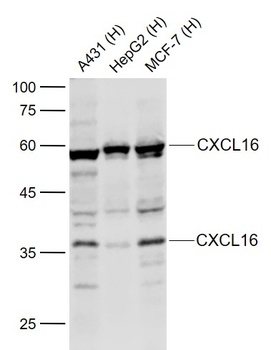 CXCL16 antibody