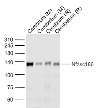 Nfasc186 Rabbit Polyclonal Antibody