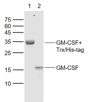 GM-CSF antibody