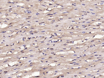 Phospho-SNAIL + SLUG (Ser246) Rabbit Polyclonal Antibody