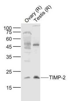 TIMP-2 Rabbit Polyclonal Antibody