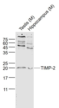 TIMP-2 Rabbit Polyclonal Antibody