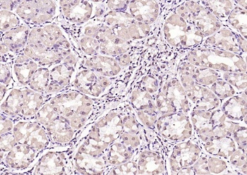Dnmt3a (phospho-Ser390 + Ser393) antibody