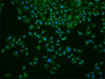 NET1 Rabbit Polyclonal Antibody