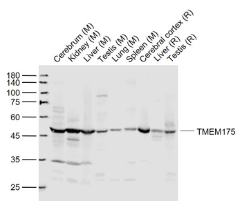 TMEM175 Rabbit Polyclonal Antibody