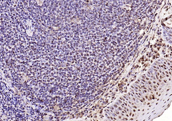 LSM6 Rabbit Polyclonal Antibody